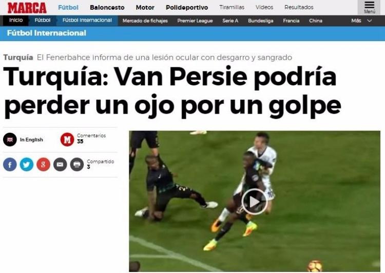 <p>Marca: "Yumruk yiyen Van Persie bir gözünü kaybedebilirdi"</p>