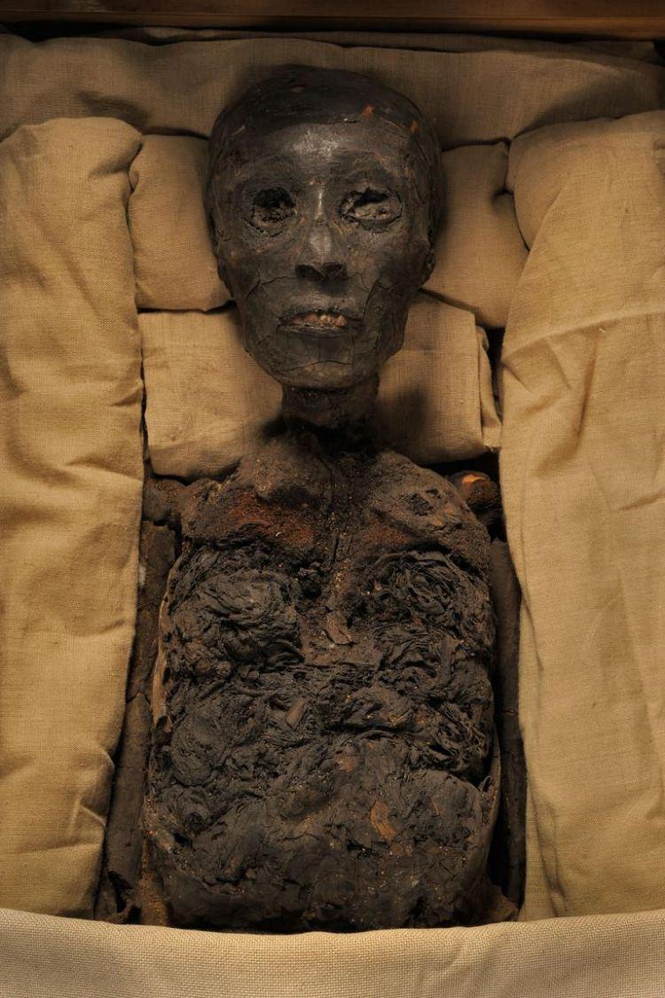 <p><strong>Tutankhamun</strong></p>

<p><br />
Antik Mısır’ın en ünlü firavunu, kardeşler arası birleşmeden dünyaya gelmişti. Akraba evliliği, çarpık ayak özrüyle doğmasına yol açmış ve olasılıkla aynı babadan kardeşi de olan karısıyla bir çocuk yapmasını engellemiş olabilir.</p>

