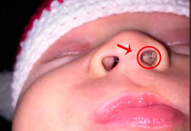 <p>Bebeğinin burnunun içinde küçük siyah noktalar olduğunu gören genç anne önce durumu anlayamadı. </p>
