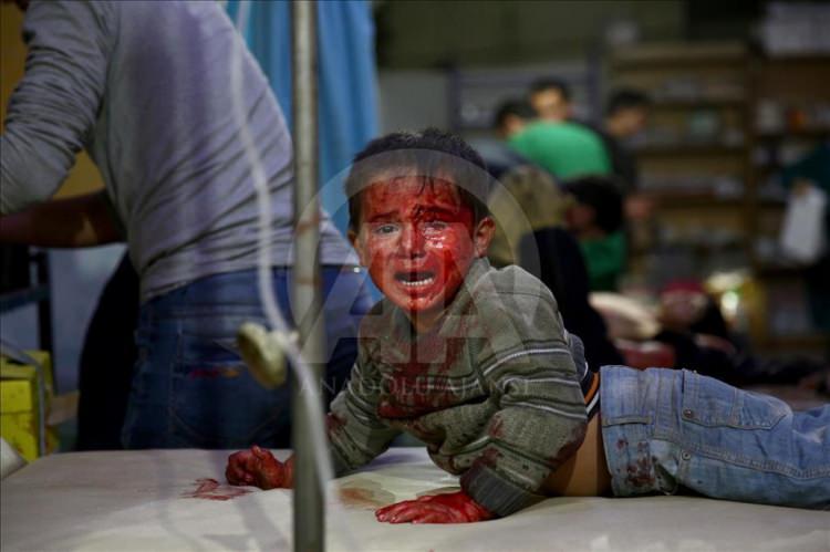 <p><span style="color:#FFFFFF">AFP foto muhabiri Abd Doumany, ''Suriyeli Çocukların Yardım Çığlığı'' başlıklı fotoğraflarıyla ''seri haber" kategorisinde ikincilik ödülüne layık görüldü. <strong>( Abd Doumany / AFP - Anadolu Ajansı )</strong></span></p>