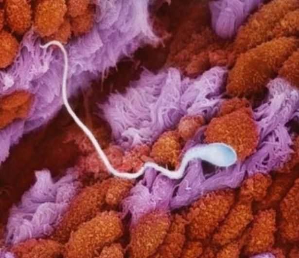 <p>Fotoğrafçı Lennart Nilsson 10 yılını harcayarak yaptığı çalışmada döllenmeden doğuma kadar embriyonun her halini fotoğrafladı. Sperm hücresi Fallop tüplerinde yumurtaya doğru ilerliyor...</p>
