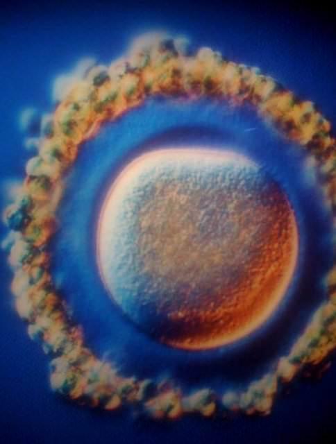 <p>Yumurta hücresi</p>

<p> </p>
