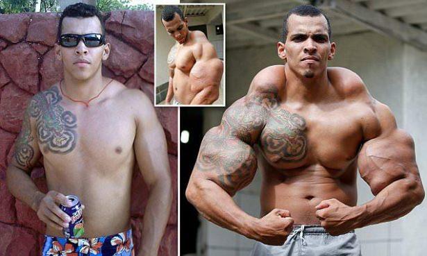 <p>"Hulk" adlı çizgi kahramanına benzemeyi hedefleyen Alves, bağımlılık yapan ilacı kullanmasından dolayı kaslarında oluşan kötü görüntü yüzünden çevresinden olumsuz tepkiler aldı.</p>