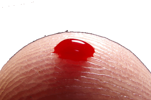 <p>TIP dilinde anemi denilen kansızlık, kandaki kırmızı hücrelerin azalmasıdır.</p>