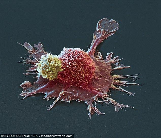 <p>Bilimsel fotoğraf stüdyosu Eye of Science tarafından çekilen bu görüntüler, habis meme kanseri hücrelerine karşı vücudun CAR-T hücresi (sarı) savunmasına büyüleyici bir bakış açısı sağlıyor. (pembe) </p>
<p> </p>