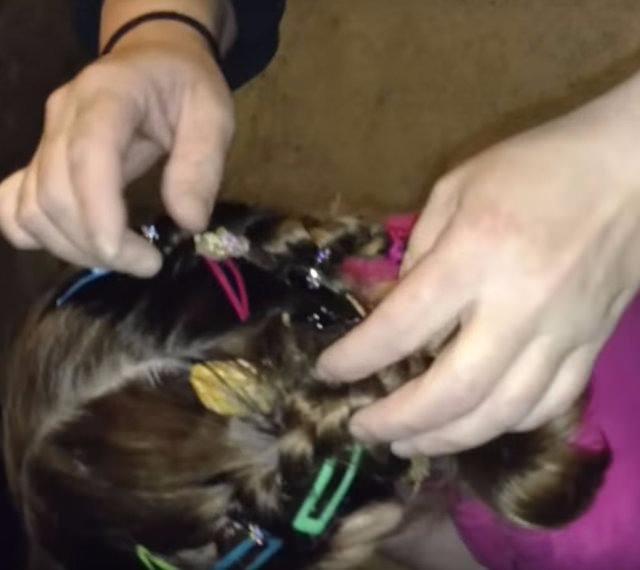 <p>Videoya göre küçük bir kızın saç örgüsünün arasına kertenkele sıkışmıştı.</p>

<p> </p>

<ul>
</ul>

<ul>
</ul>

