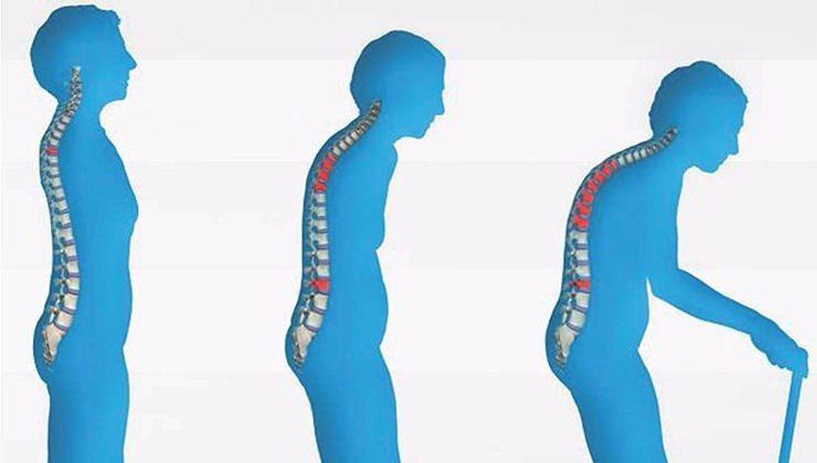 <p>Osteoporoz Sorunlarını Önler: Sağlıklı kemikler için faydalı olan tuzun yaklaşık 4/1'i kemiklerde depolanmaktadır.</p>
