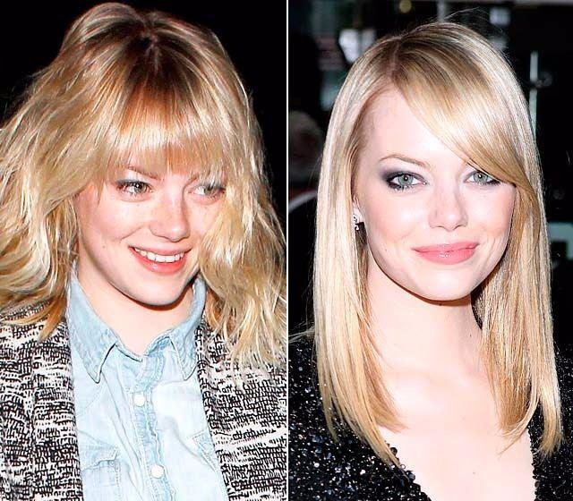 <p>Emma Stone</p>
