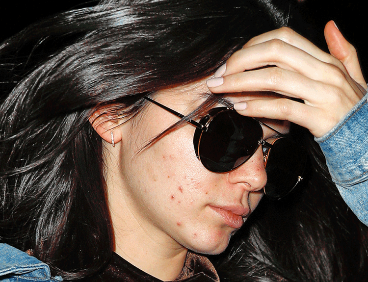 <p>Güzelliği ve pürüzsüz cildiyle ünlü markaların elçiliğini üstlenen Jenner, makyajsız yakalandı. </p>
