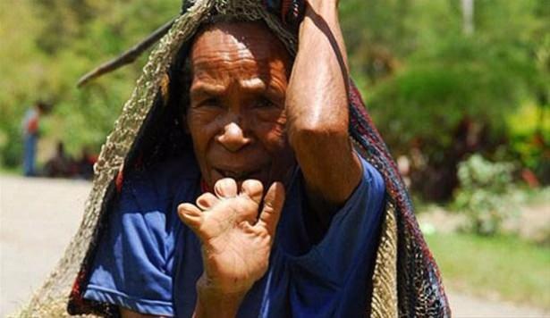 <p>Endonezya'da bir adada yaşayan Dani kabilesi'nde dünyanın en garip yası tutuluyor...<br />
<br />
Dani Kabilesinin kadınları kocaları öldüğünde el parmaklarını kesiyor...</p>

<p> </p>

<p> </p>
