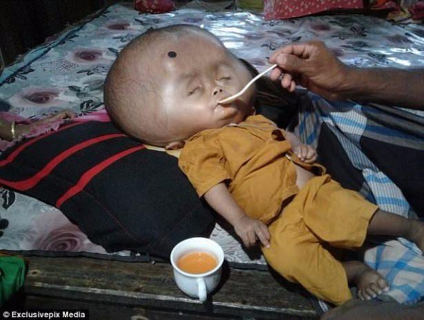 <p>Daily Mail'in haberine göre; Bangladeş'in güneyinde yaşayan iki yaşındaki Emon'un kafası tam 9 kilo ağırlığında...<a href="http://www.ahaber.com.tr/galeri/dunya/bangladesli-emonun-kafasi-sureli-buyuyor">.</a></p>
