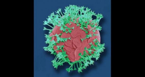 <p>Plankton ya da okyanusların üst tabakasında yaşayan tek hücreli deniz bitkilerinden biri.</p>
<p> </p>