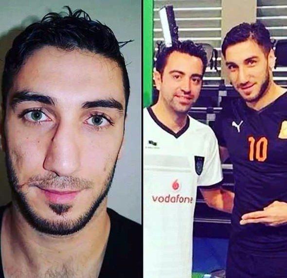 <p><strong>İsmael Mahmoud</strong><br />
<br />
Katarlı Umm Salal takımının forveti de burun estetiği yaptıran, ve bunun için ülkemizi tercih eden bir futbolcu.</p>
