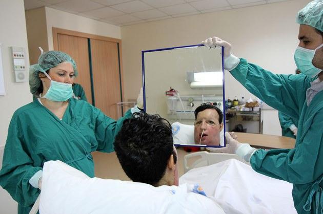 <h2>Antalya'da yüz nakli olduktan sonra enfeksiyon riski nedeniyle odasında tutulan Recep Sert, 84 gün sonra ilk kez odasından çıktı ve hastane koridorundaki pencereden denizi gördü.</h2>