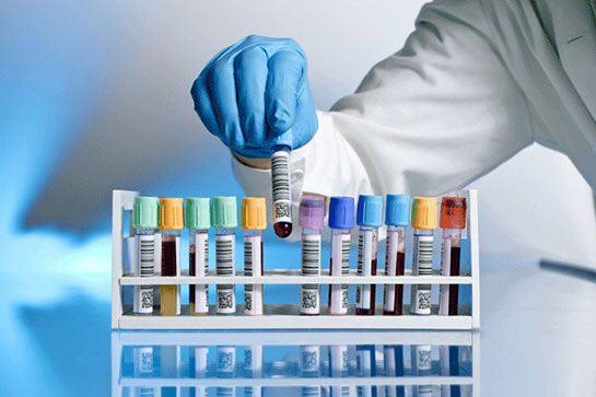<p><strong>AST ALT KARACİĞER ENZİM TESTLERİ</strong></p>