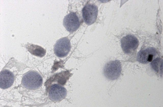 <p>Yapılan ölçüm ile kişiye sperm kalitesinin yeterli olup olmadığı net bir şekilde belirtiliyor.</p>