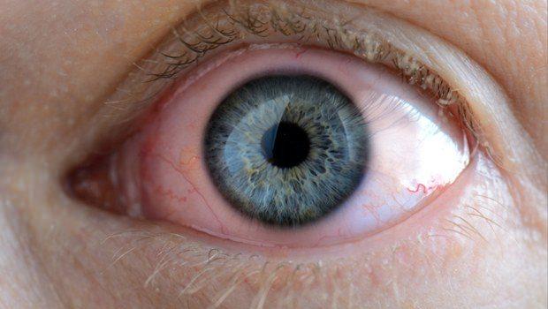 <p>Gözün içinde ve dışında oluşan lekelerin kanserin habercisi olabileceğini biliyor muydunuz? Peki, göz kanseri nedir? Sizler için teşhisi zor olan göz kanserini araştırdık. İşte göz kanseri hakkında bilinmeyenler...</p>
