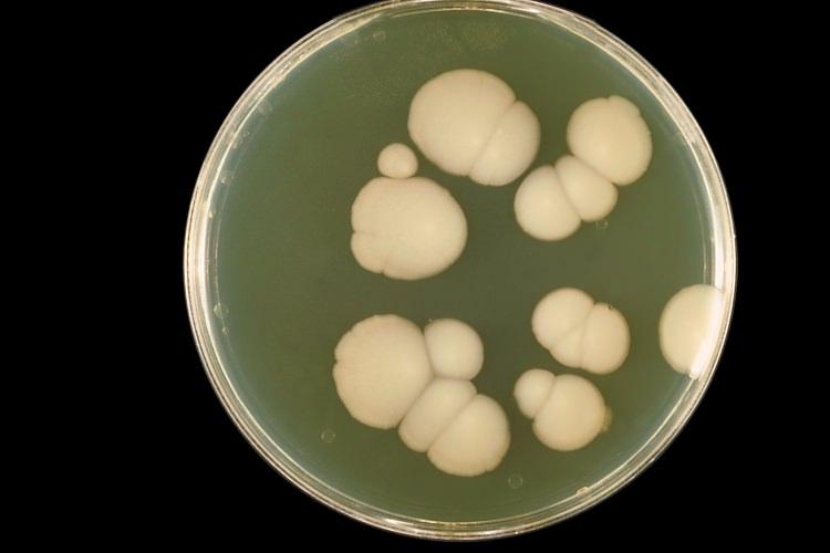 <p>Candida mantarları gıdalardan aldığınız sofra şekeriyle imal edilmiş ürünleri ve unlu mamülleri önce piruvat’a sonradan asetaldehid ve karbondioksit’e dönüştürür. </p>
