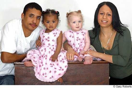 <p>2006 yılının Şubat ayında Kylie ve Remi Horder çiftinin ikiz kızları oldu. Hem Kylie hem de Remi melezdi, yani anne ve babalarından biri beyaz, diğeri ise siyahtı. Sonuç olarak ikiz kızlarının her birinde farklı genler toplanmış ve biri siyah, diğeri beyaz doğdu.</p>
<p> </p>
