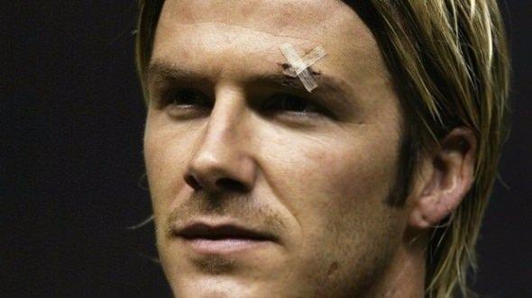 <p>David Beckham<br />
<br />
2003 yılındaki Arsenal yenilgisi sonrası Sir Alex önündeki krampona tekme atmış ve fırlayan o krampon Beckham'ı fotoğraftaki duruma sokmuştu.</p>