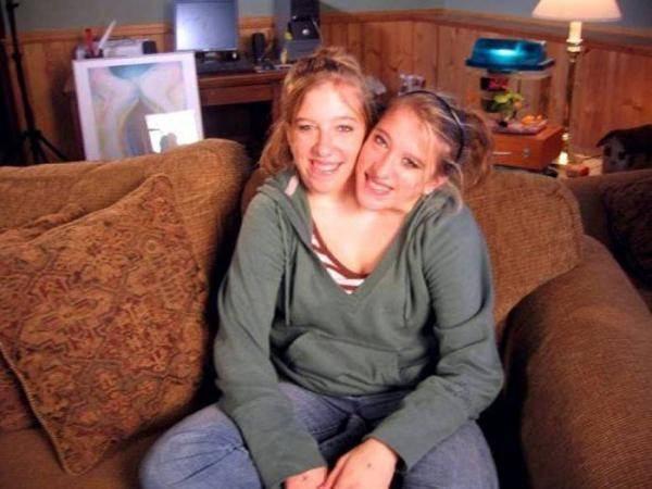 <p>Abigail Hensel ve Brittany Hensel ikizlerini görenler hayrete düşüyor. </p>
