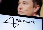 Neuralink onay aldı: Beynine çip taktırmak isteyen insanlar aranıyor!