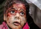 İsrail Gazze'yi kana buladı! Onlarca çocuk yaralandı