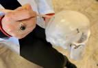 Çatalhöyük'te inanılmaz keşif! 8 bin 500 yıllık beyin ameliyatı