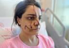 Marmaray’da saldırıya uğrayan kadın yüzündeki 40 dikişle dehşet dolu anları anlattı 