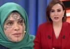 Y&uuml;z&uuml;ndeki d&ouml;vmelerle g&uuml;ndem olmuştu! Nazan &Uuml;nal'dan sunucu Didem Arslan Yılmaz'a şok su&ccedil;lama