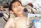 Açlığın kenti Madaya nasıl bu hale geldi?