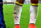 Fenerbahçeli yıldızın bacağı bu hale geldi!