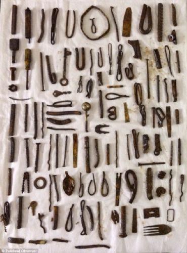 <p>G&uuml;nay Afrikalı bir gen&ccedil; mide ağrısı şikayetiyle doktora gitti ve &ccedil;ekilen r&ouml;ntgen sonucuna doktorlar da inanamadı.&nbsp;</p>

<p>&nbsp;</p>
