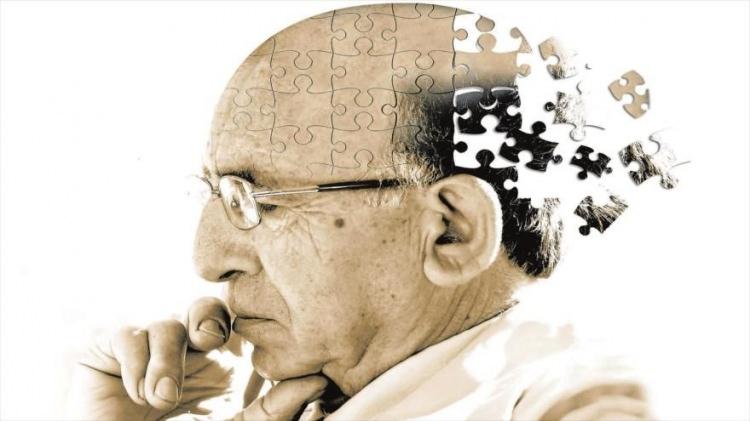 <p>Alzheimer, yaşın ilerlemesiyle birlikte kişinin hafızasında silinmelere ve hatırlamamalara neden olan bir hastalık türüdür. </p>
