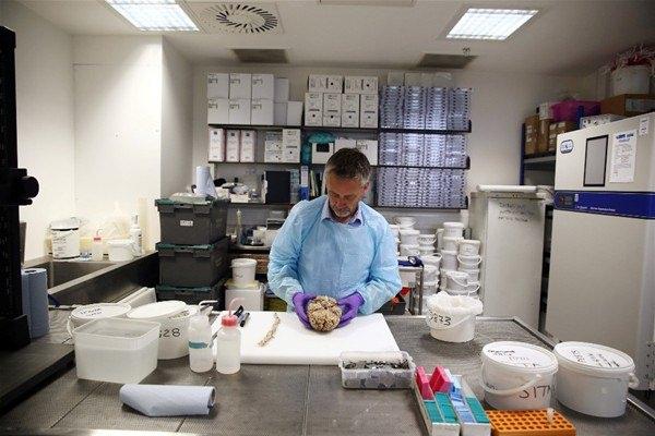 <p>Prof. Gentleman her gün dilimleyerek beyinleri inceliyor ve araştırmalar için ilgili yerlere bu beyin parçalarını gönderiyor.</p>
