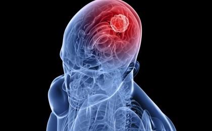 <p><strong>Belirtileri dikkate almak gerekir</strong></p>
<p>Hastalığın en sık şikayetleri arasında boyun ağrısı, baş ağrısı, omuzlarda, kollarda, sırtta, belde ağrıları görülür. </p>