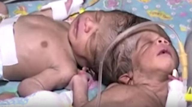 <p>35 yaşındaki Sarifa Khatun Hindistan'da doğum yaptıktan sonra gördükleri karşısında şoke oldu.</p>