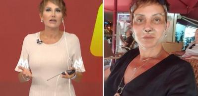 Canlı yayında konuşmakta zorlanan Serap Pak&ouml;z estetik iddiasına sert &ccedil;ıkıştı!