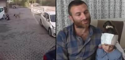 K&uuml;&ccedil;&uuml;k &ccedil;ocuğa pitbull saldırdı