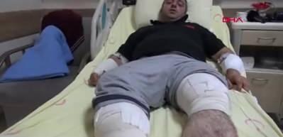 Tokat’ta bir çiftçi ayı saldırısından bakın nasıl kurtuldu