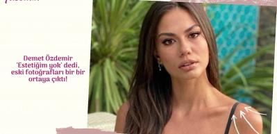 Demet &Ouml;zdemir estetik iddialarına yanıt verdi!