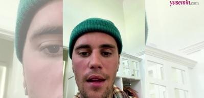 Justin Bieber'dan korkutan açıklama: "Hastalığım kötüye gidiyor"
