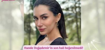 Hande Doğademir'in son hali beğenilmedi! 