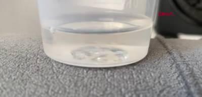 Bağcılar'da maaşını istediği muhasebeci bardak fırlattı iddiası, g&ouml;z&uuml;ne 32 dikiş atıldı