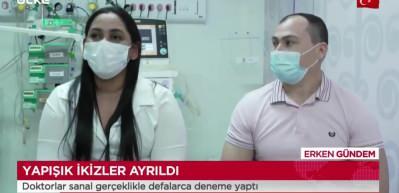 Yapışık ikizler sanal gerçeklikle ayrıldı!