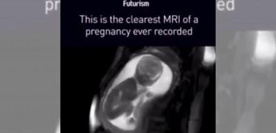 Anne karnındaki bebeğin en net g&ouml;r&uuml;nt&uuml;s&uuml; ortaya &ccedil;ıktı!