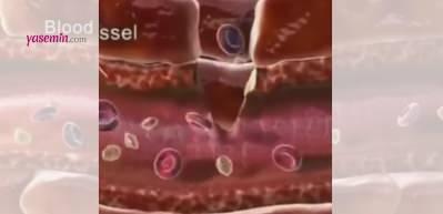 Yaralandığımızda v&uuml;cudumuz kanamayı işte b&ouml;yle durduruyor...