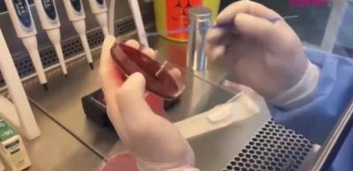 Depremin vurduğu Hatay'da 'gaita testi' önlemi! Gaita testi nedir ne için yapılır?