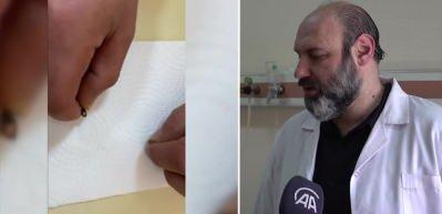 Anne babalar dikkat! Mıknatıslı toplar &ccedil;ocuğun bağırsağını deldi...