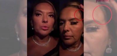 Demet Akalın &ouml;l&uuml;mden d&ouml;nd&uuml;: Nasıl sağ &ccedil;ıktık algılayamıyorum!